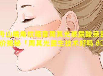 舟山嘴角纹福音周其光玻尿酸亲民价揭秘「周其光医生技术好吗 🦢 」